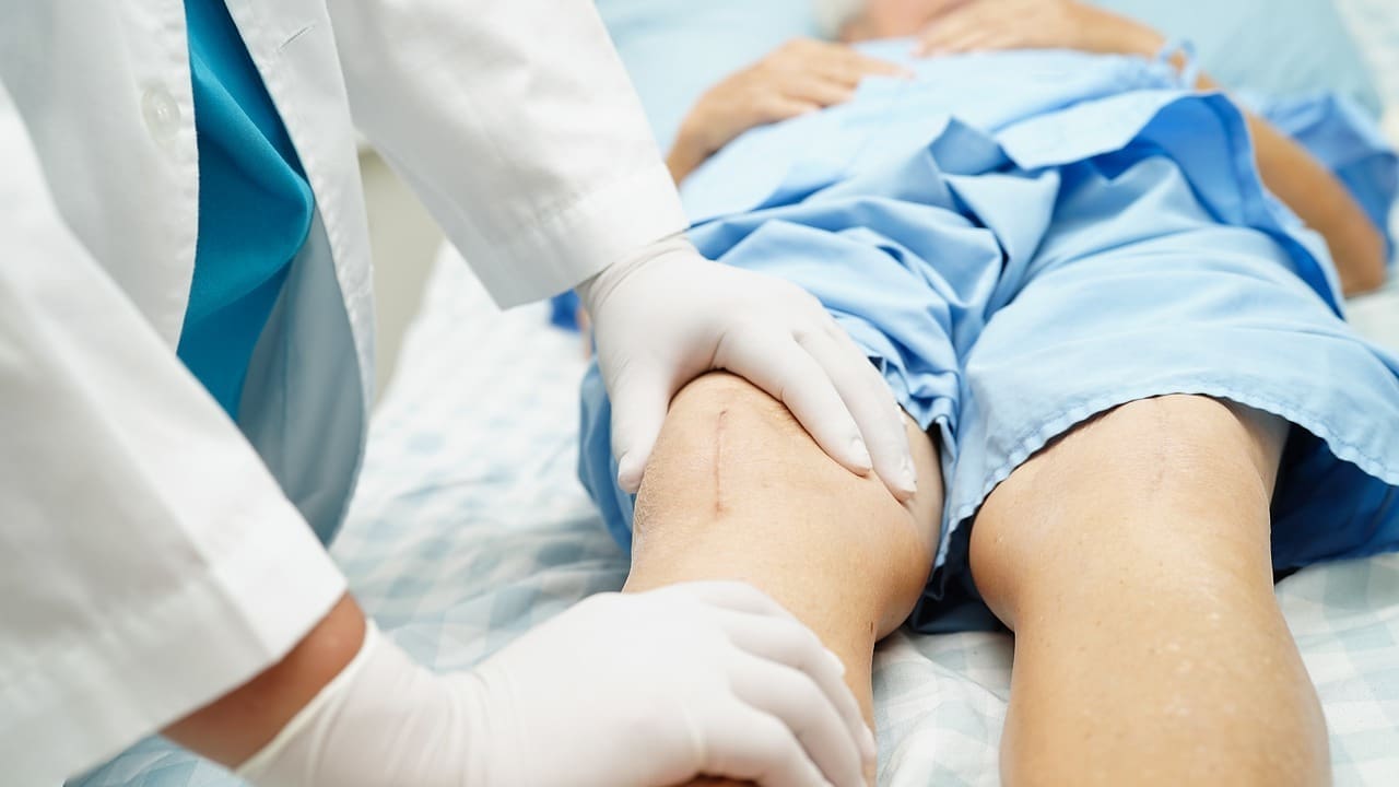 What to Expect After Knee Scope Surgery: 7 Essential Recovery Tips