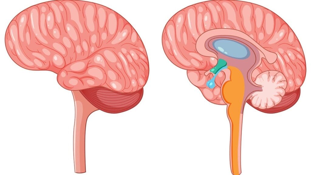 Medulla Oblongata Tumor in Adults Medulla Oblongata Tumor in Adults