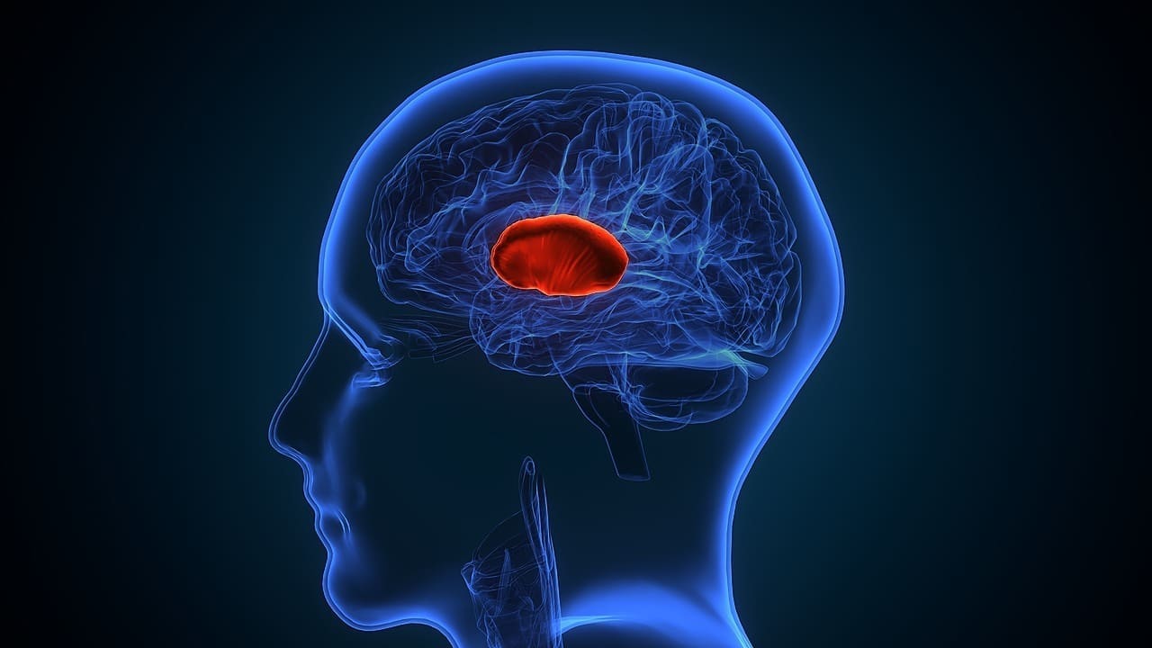 Meningioma Tumor Locations
