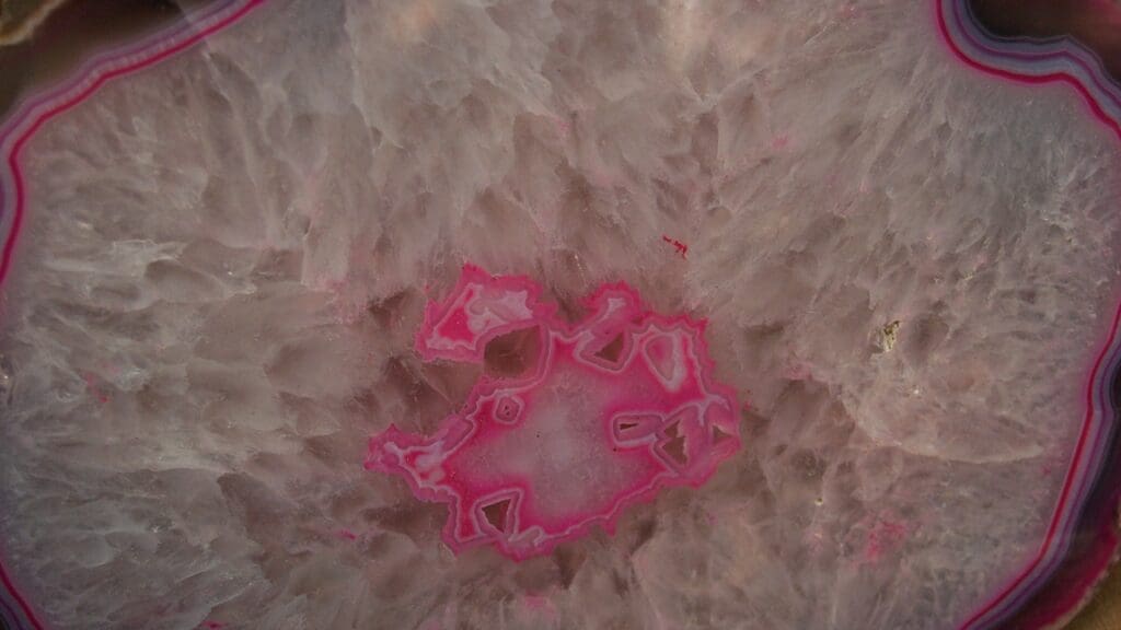 Merkel cell carcinoma