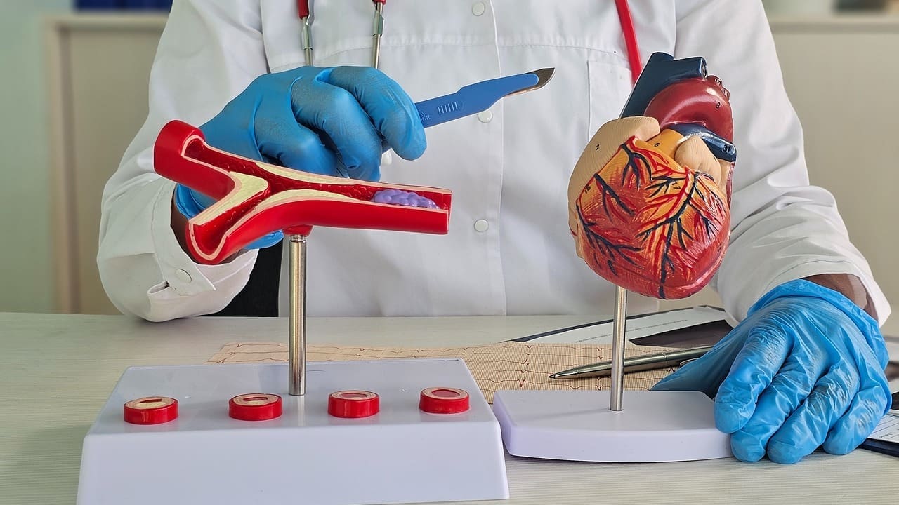 Patent Ductus Arteriosus Murmur