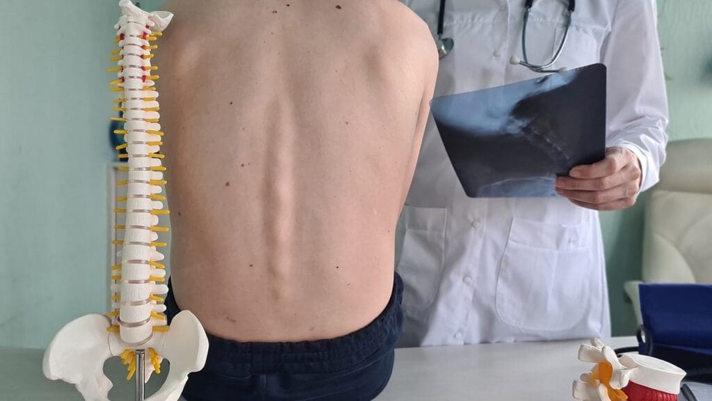 Primary Spinal Tumor Survival Rates Primary Spinal Tumor Survival Rates