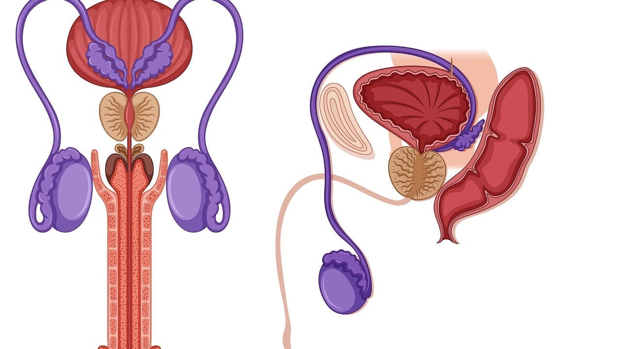 Prostate Cancer Recurrence