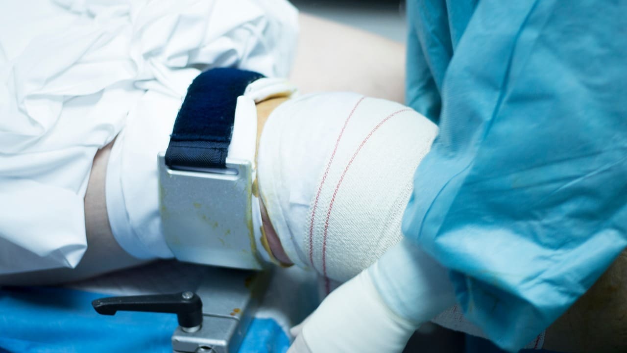 Recovery After Knee Scope Surgery