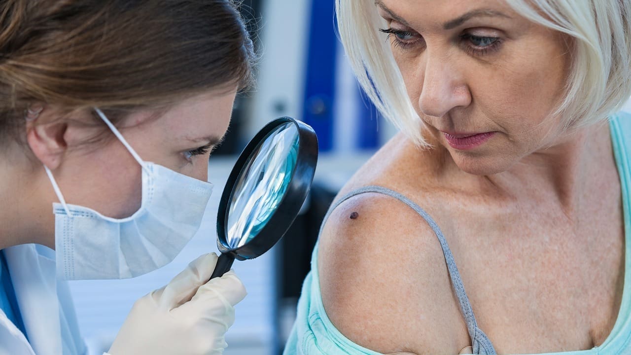 Remove Basal Cell Carcinoma