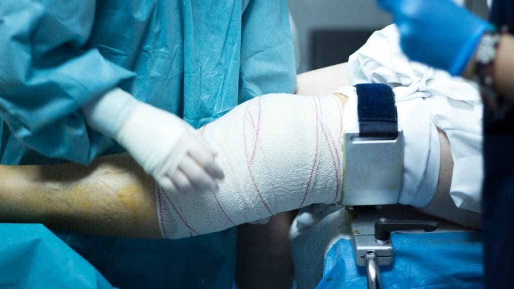 Repair a Torn ACL with Arthroscopic Surgery