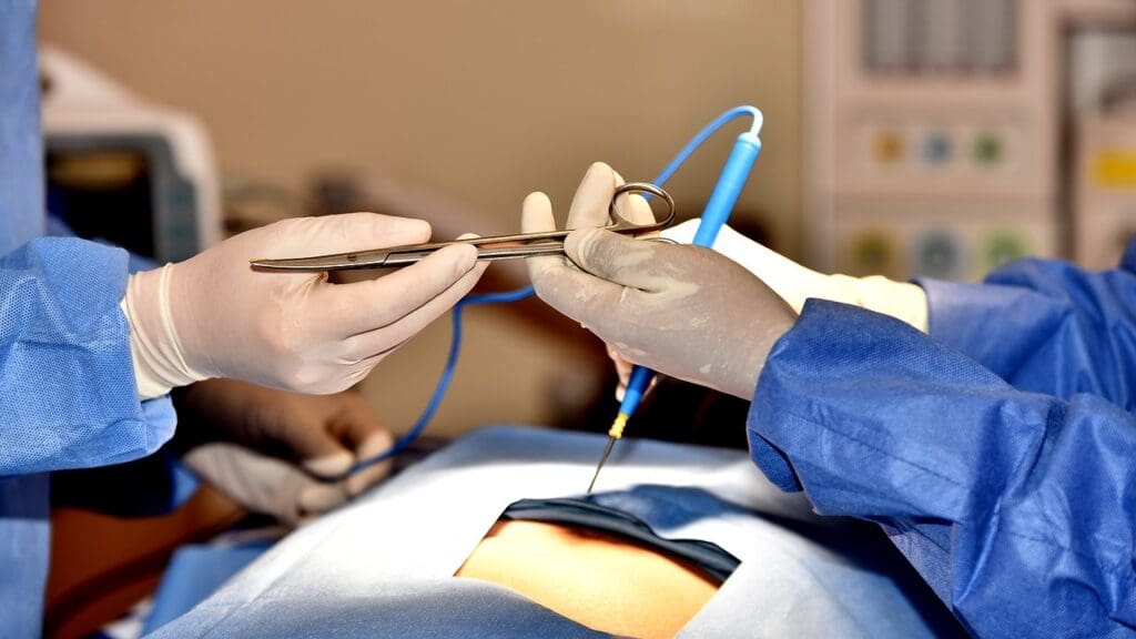 Repair a Torn ACL with Arthroscopic Surgery