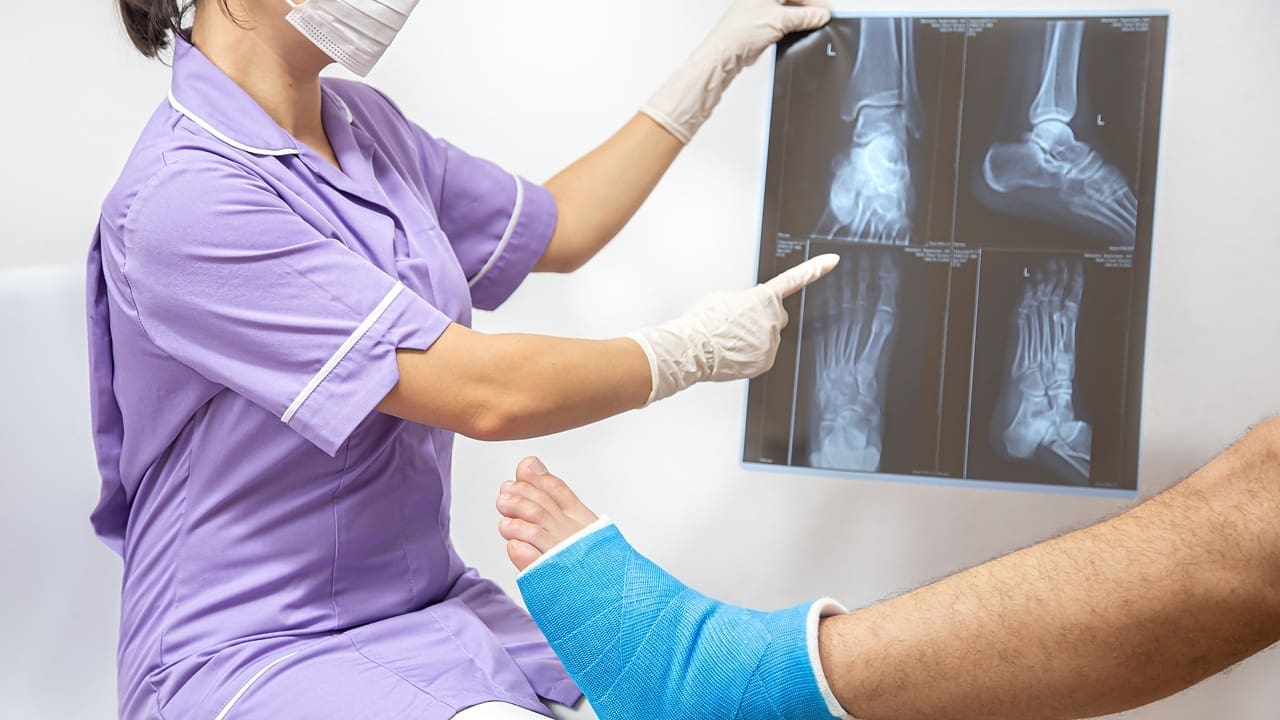 Repair a Torn ACL with Arthroscopic Surgery