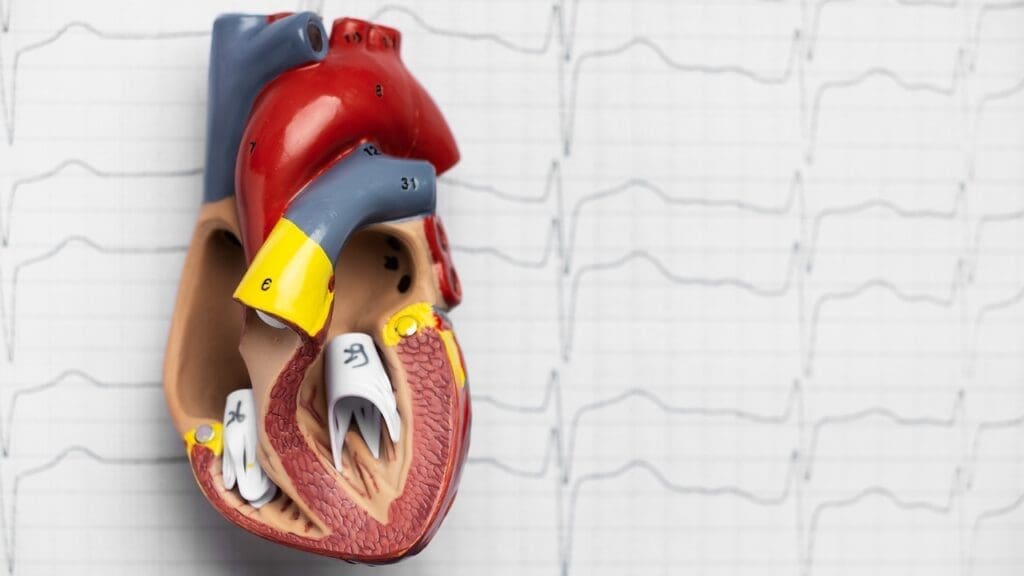 Reverse Heart Disease