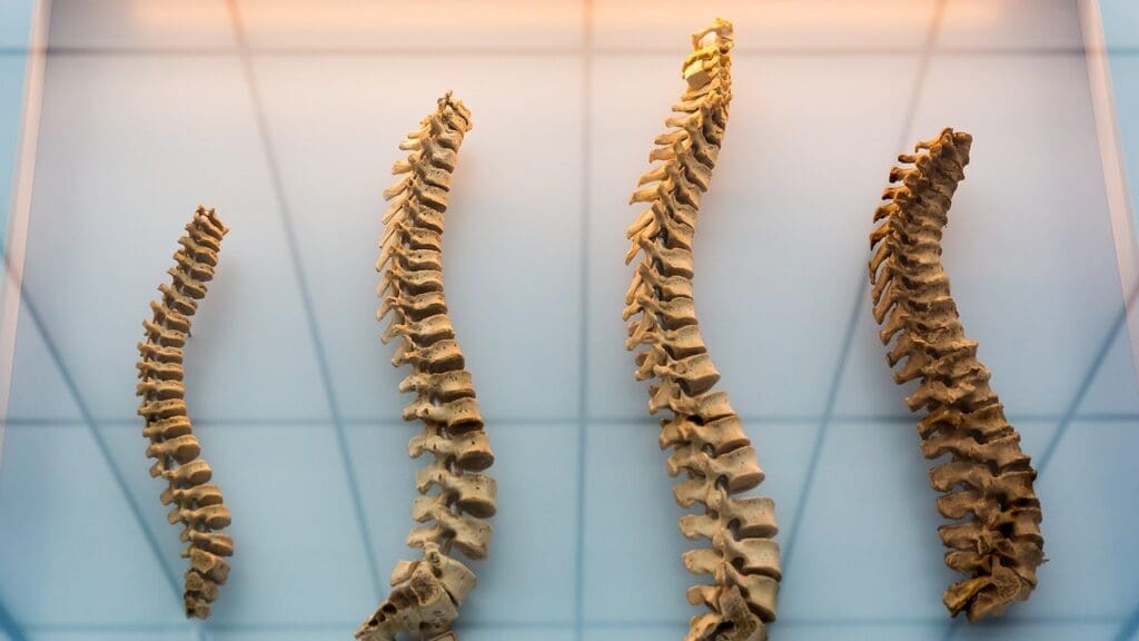 Spinal Cord Injury Levels