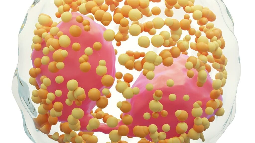 Stage 4 Large B Cell Lymphoma