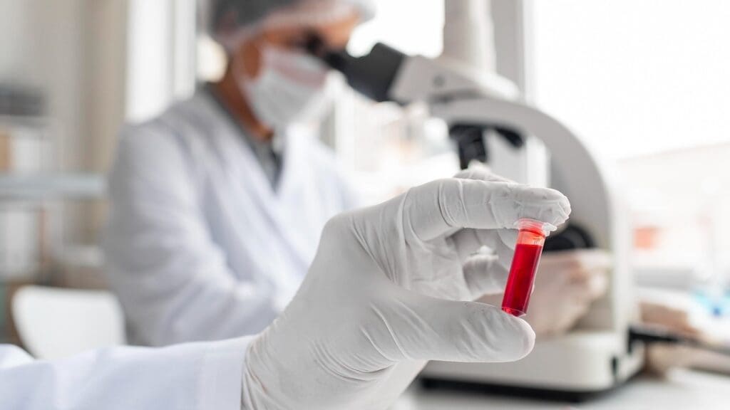 Stem Cell Transplantation