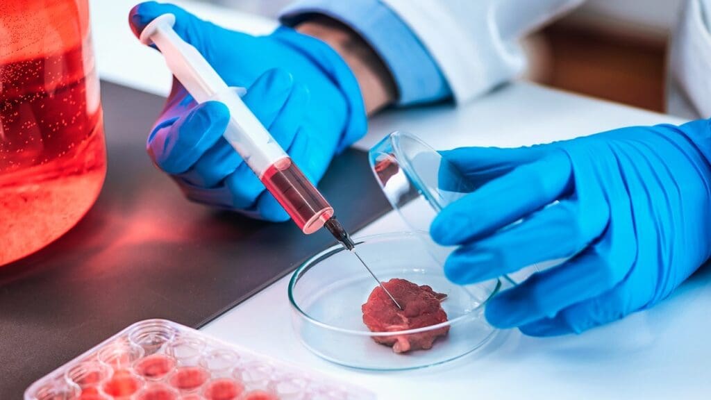 Stem Cell Transplantation Stem Cell Transplantation