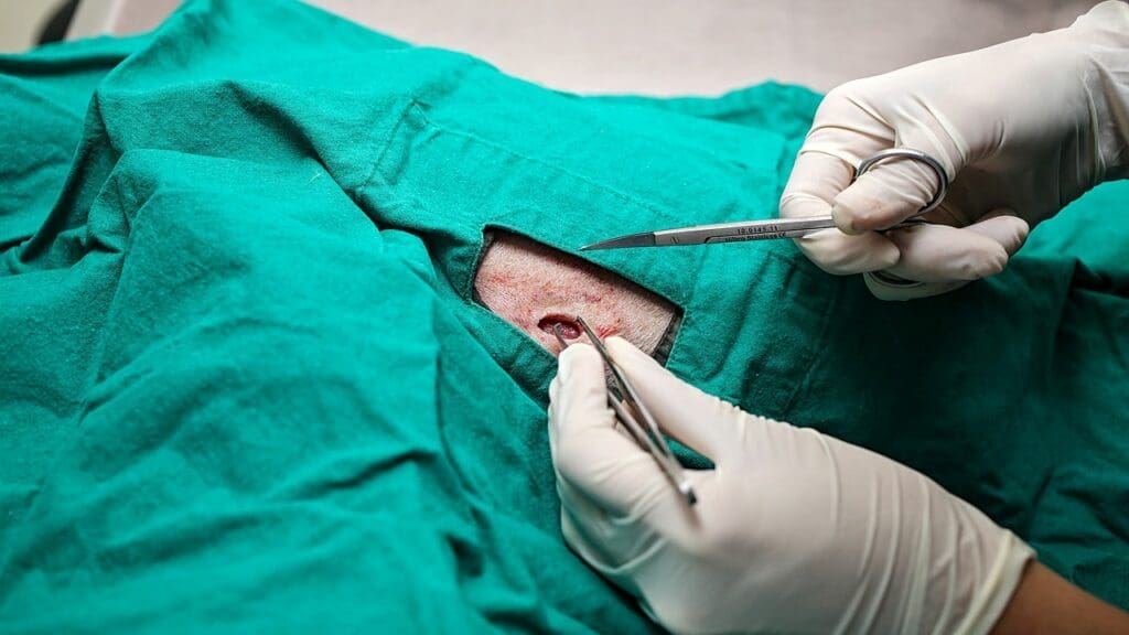  Surgery for Basal Cell Carcinoma