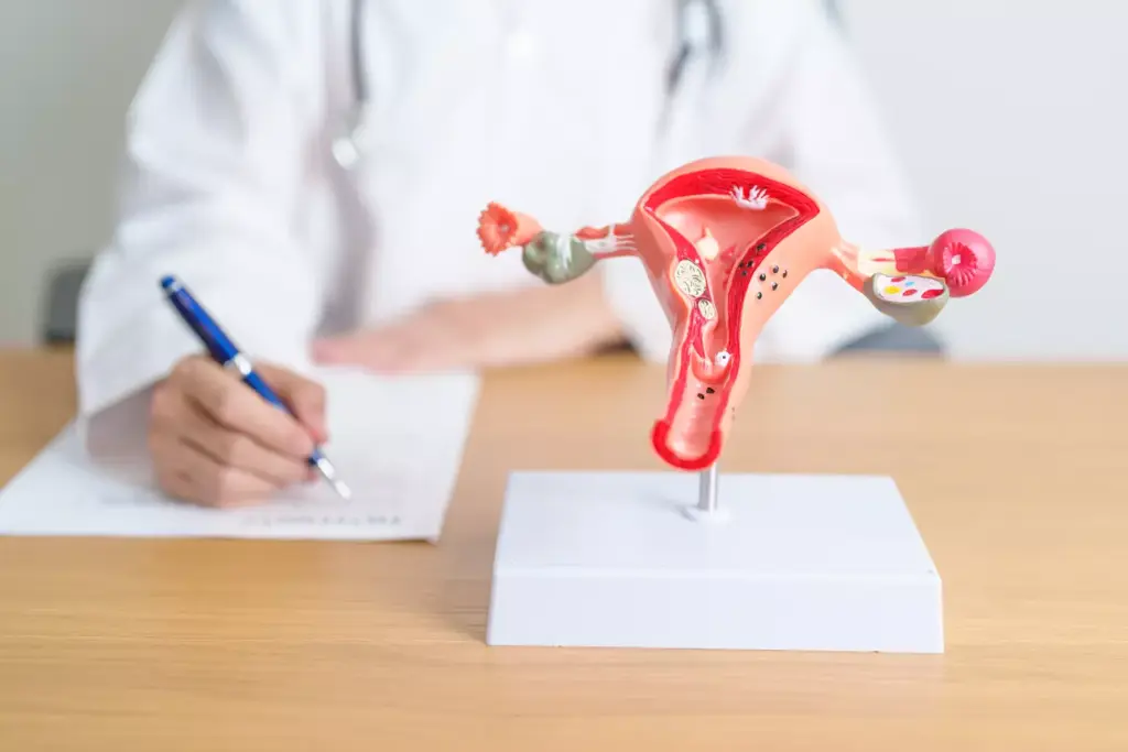 Surgical System for Hysterectomy