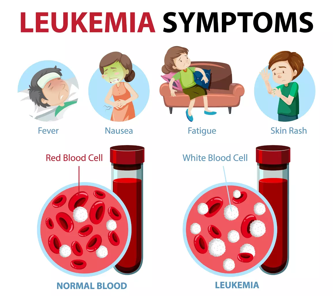 Teenage Leukaemia Symptoms