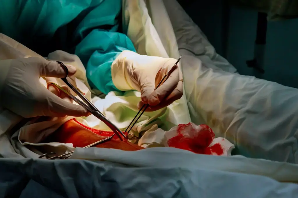 The Rich History of CABG Surgery The Rich History of CABG Surgery