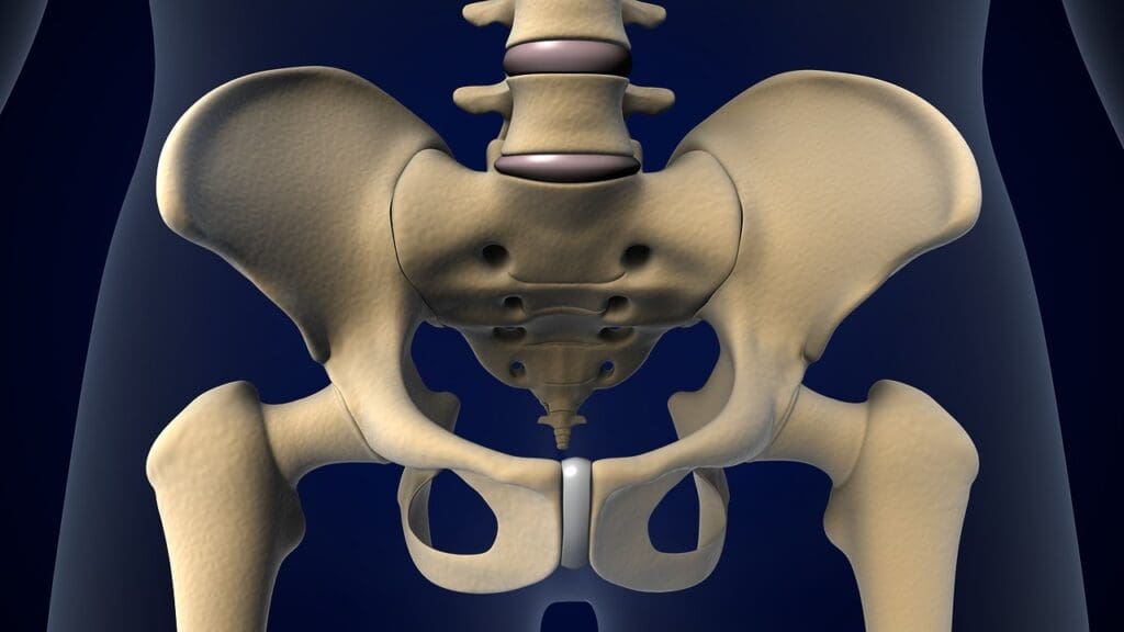 Titanium Artificial Hip