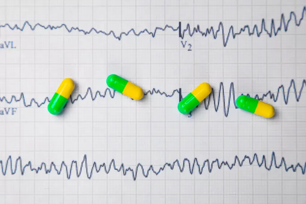 Understanding Atrial Arrhythmias