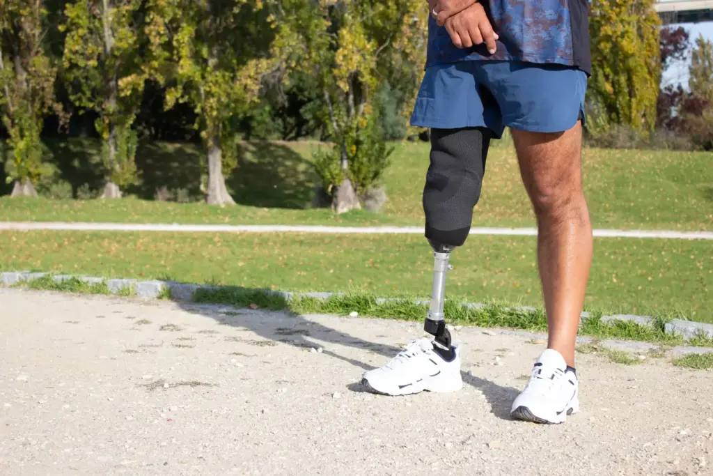 Understanding Bionic Knee Replacement Technology