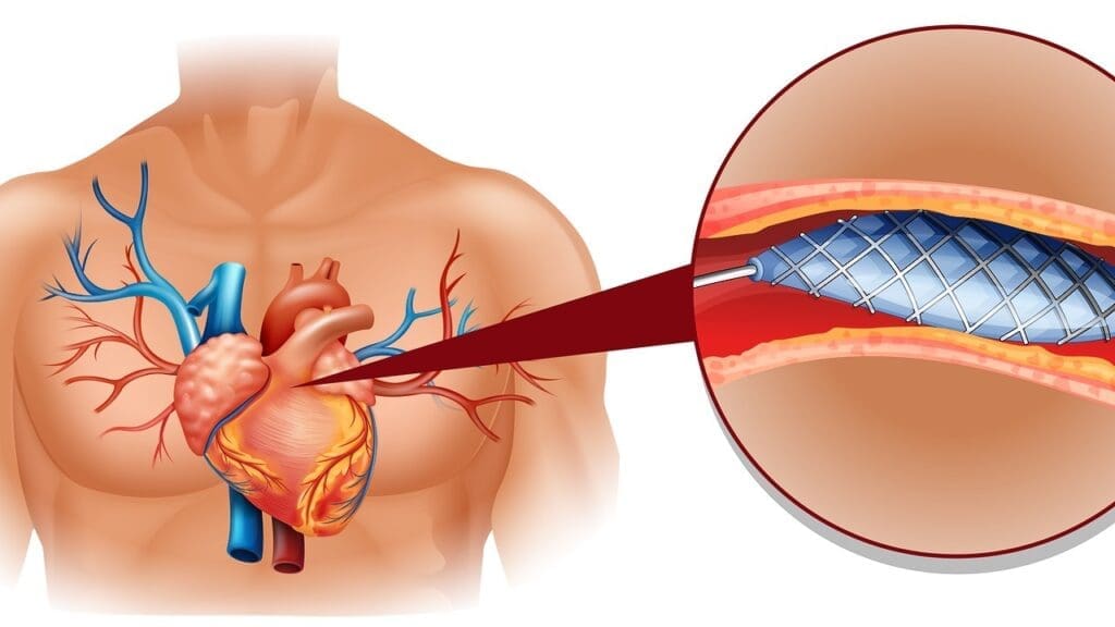 Understanding Blood Vessels