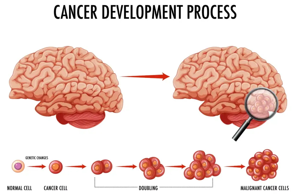 Understanding Brain Tumors