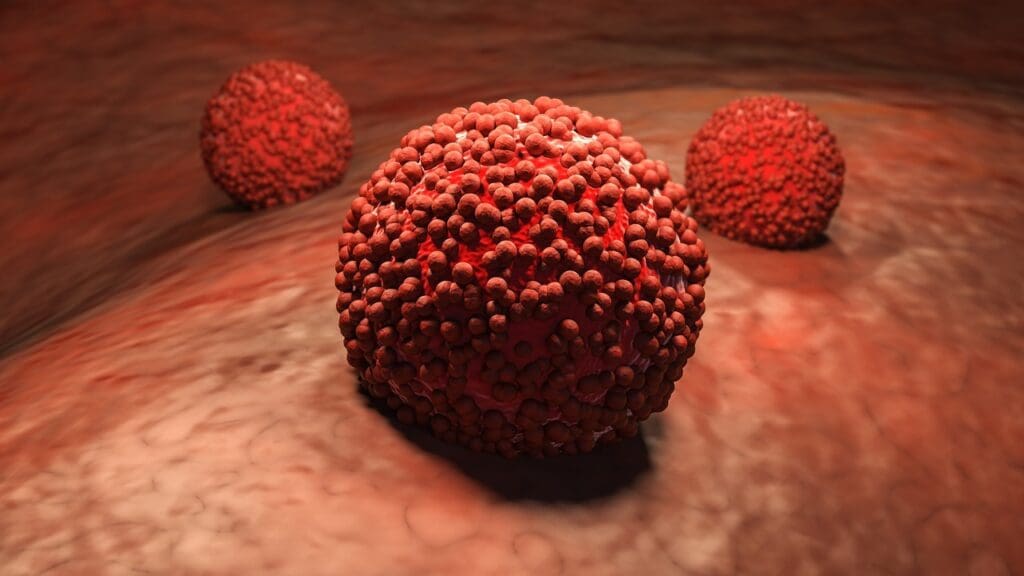 Understanding Malignant Spinal Tumors