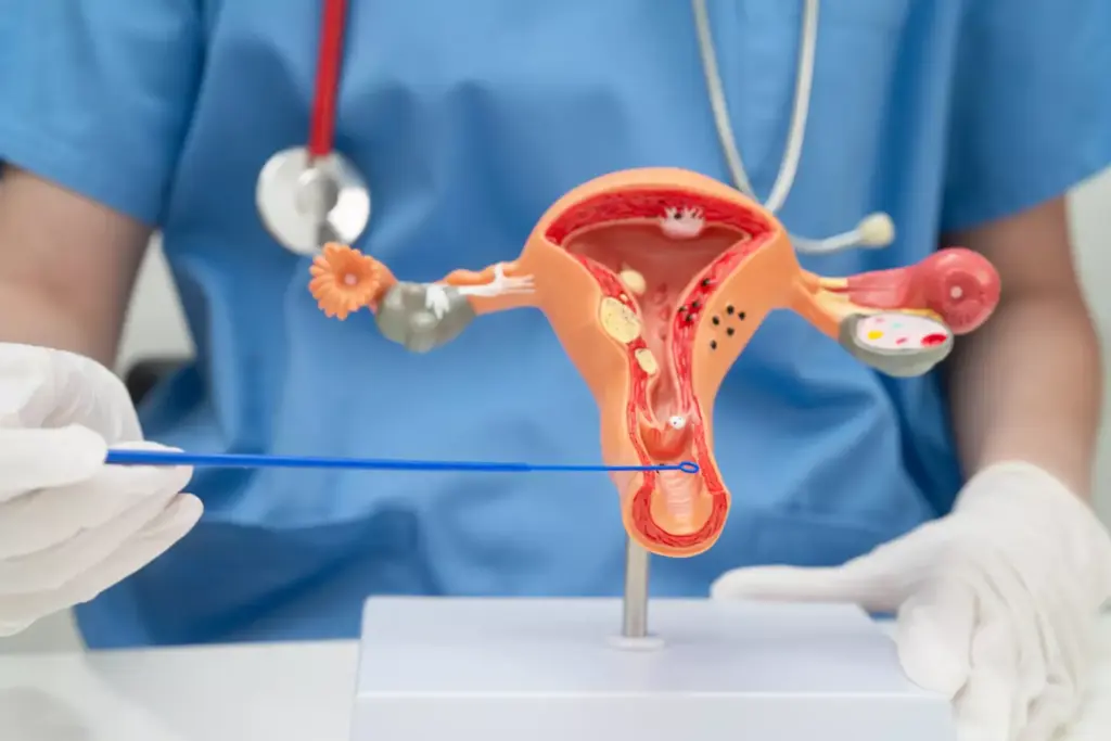 Understanding Robotic Hysterectomy