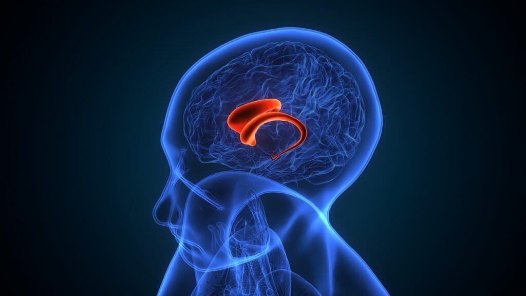 Understanding What Is Hydrocephalus 