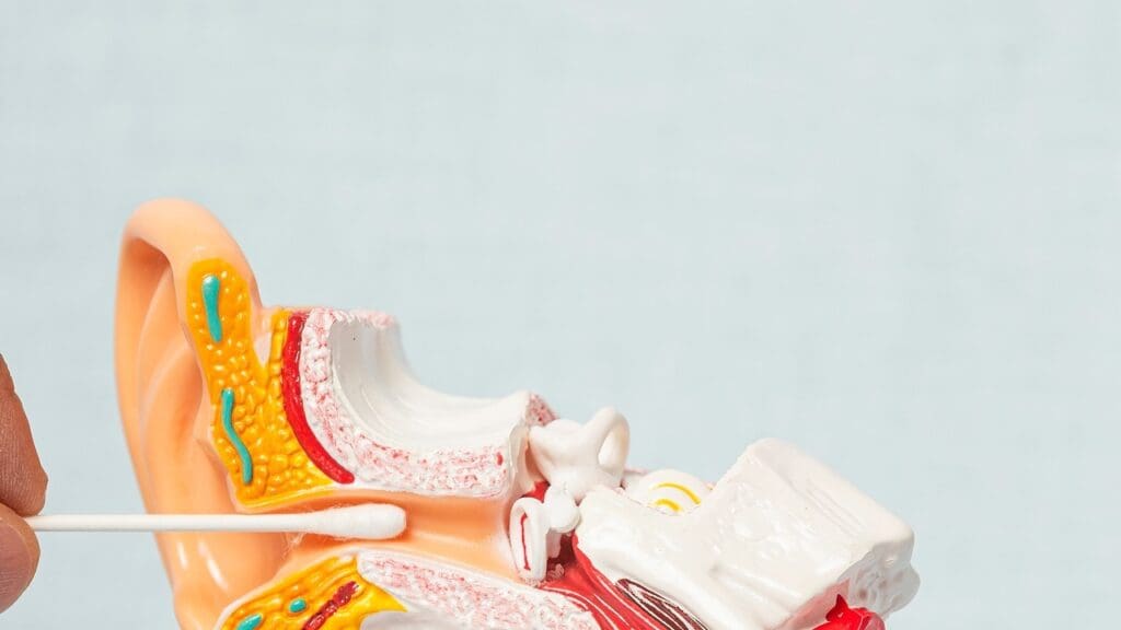 Vestibular Schwannoma Anatomy