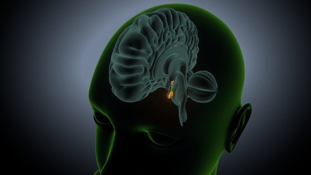 What Are Brain Stem Tumors