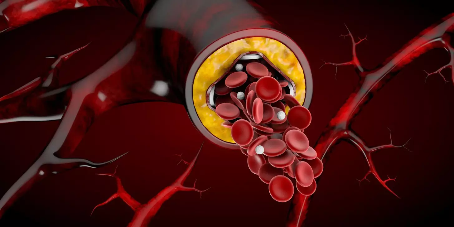 What Happens When Bone Marrow Enters the Bloodstream