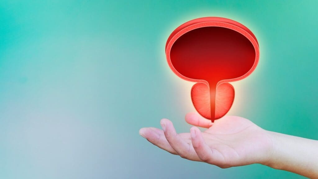 What Happens When Prostate Cancer Comes Back After Radiation Therapy?