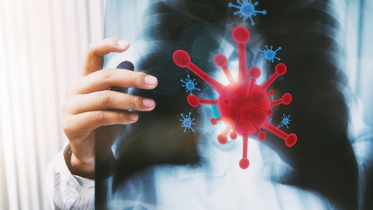 What Is Chronic Graft GVHD