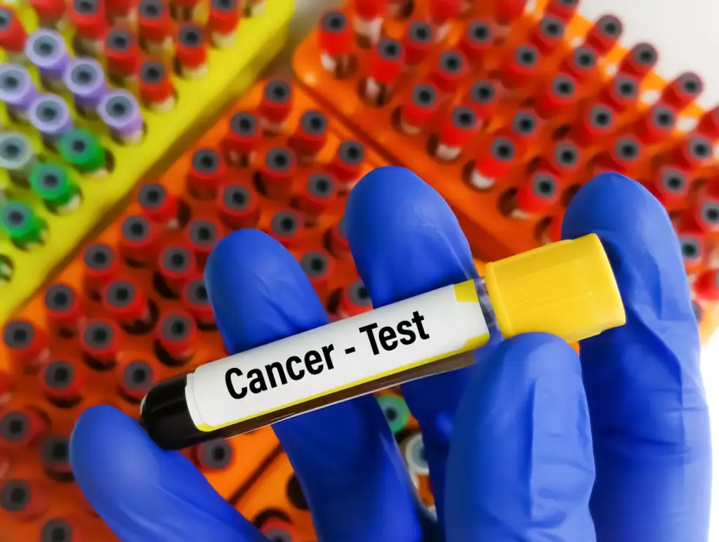 What Is Remission in Cancer