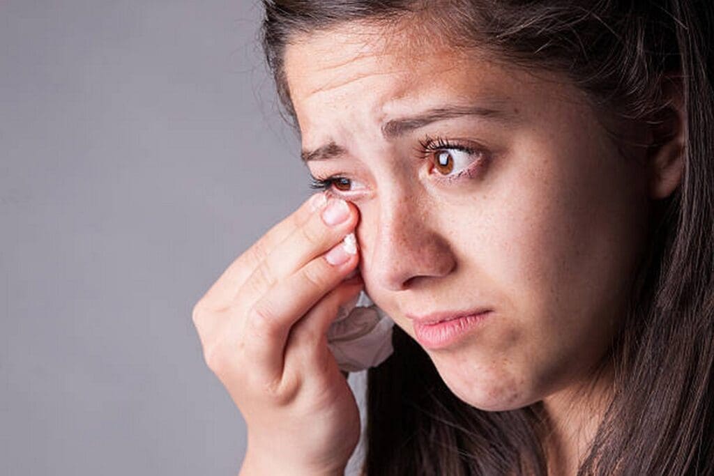 a patient with noticeable dark circles under her eyes a patient with noticeable dark circles under her eyes