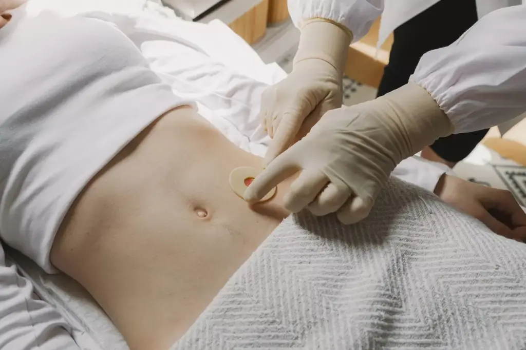 abdominal aneurysm size for surgery