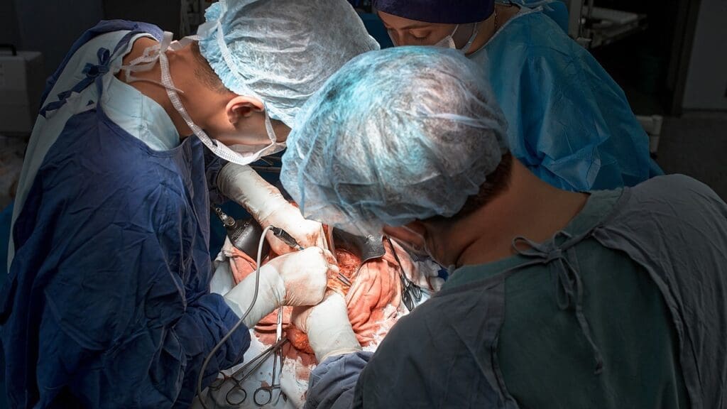 abdominal aortic aneurysm abdominal aortic aneurysm