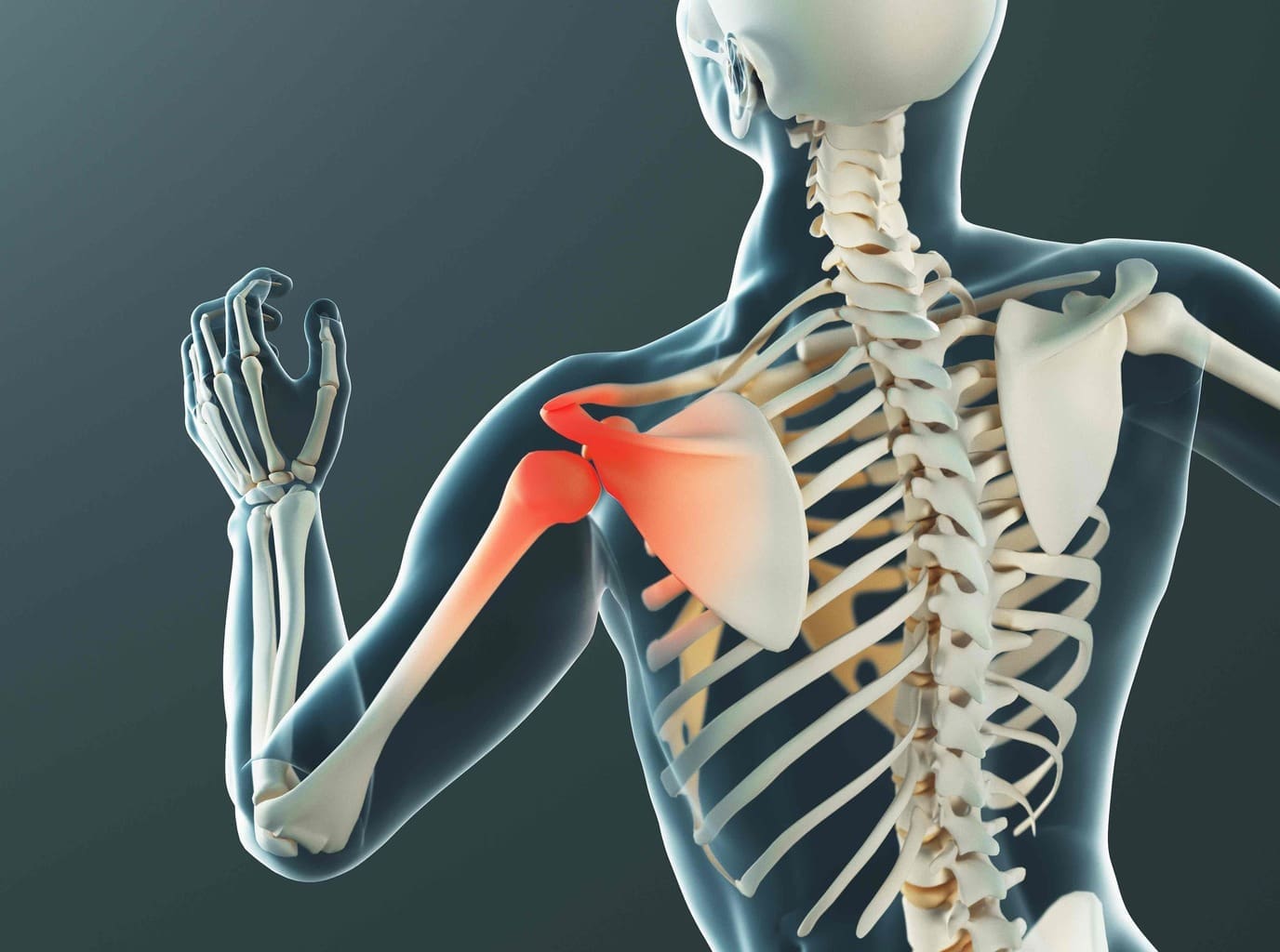 anatomic shoulder replacement