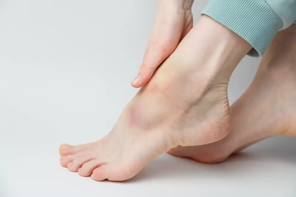 ankle sprain or fracture