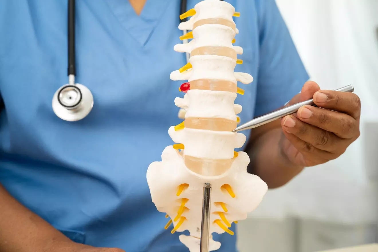 anterior lumbar fusion