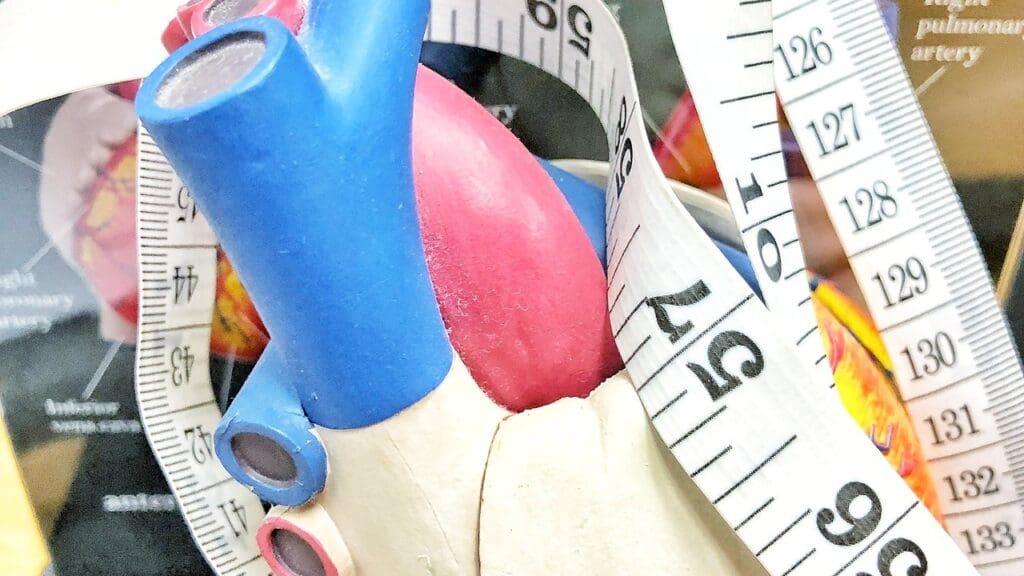 aortic stenosis measurements