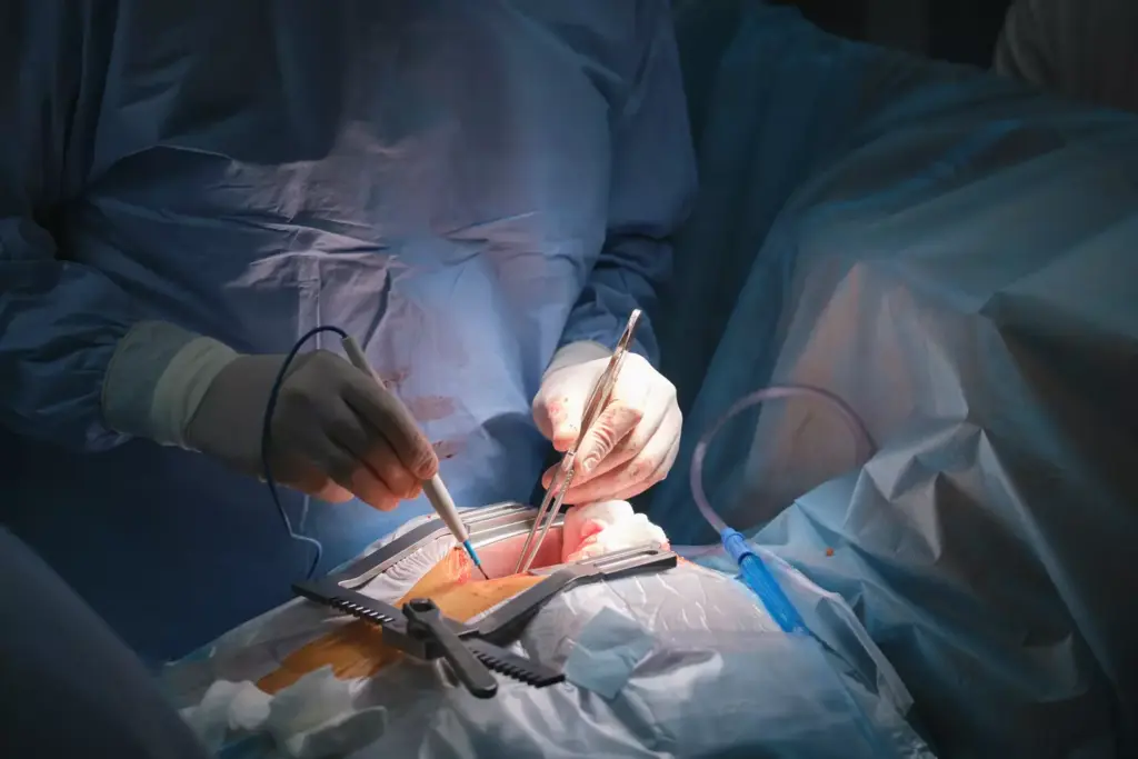 How to Repair an Ascending Aortic Aneurysm: Step-by-Step Guide