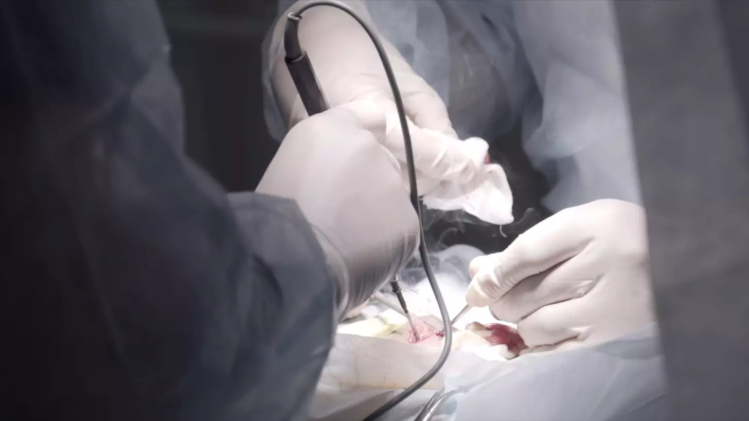 ascending aortic aneurysm surgery