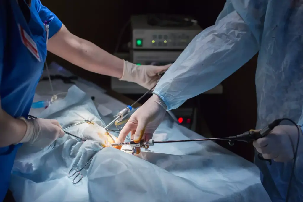 How to Treat Ascending Aortic Aneurysm: Step-by-Step Guide to Treatment Options