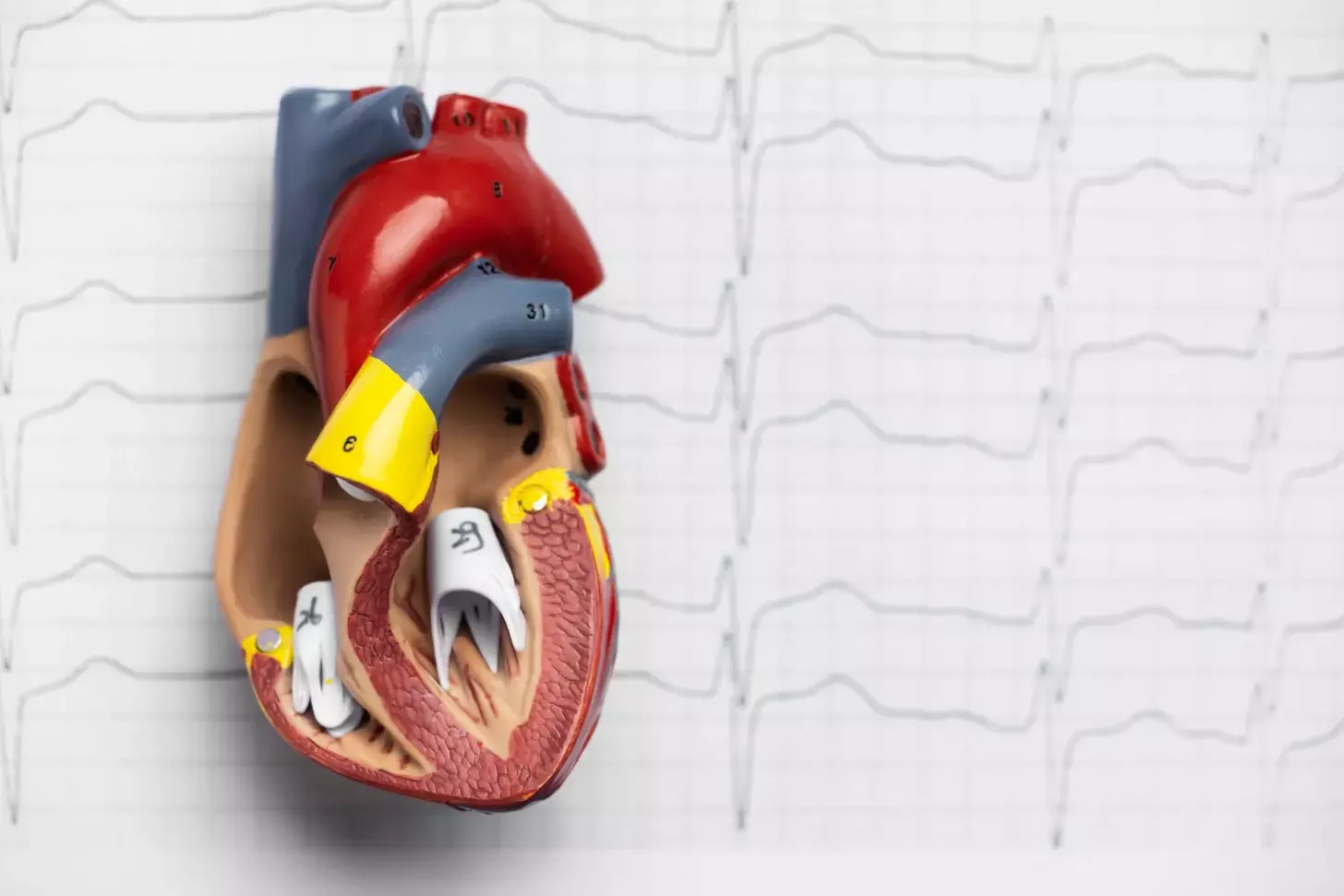 atrioventricular valves