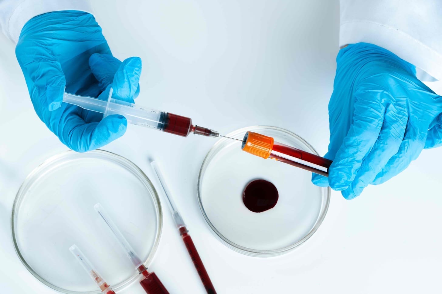 autologous hematopoietic stem cell transplantation