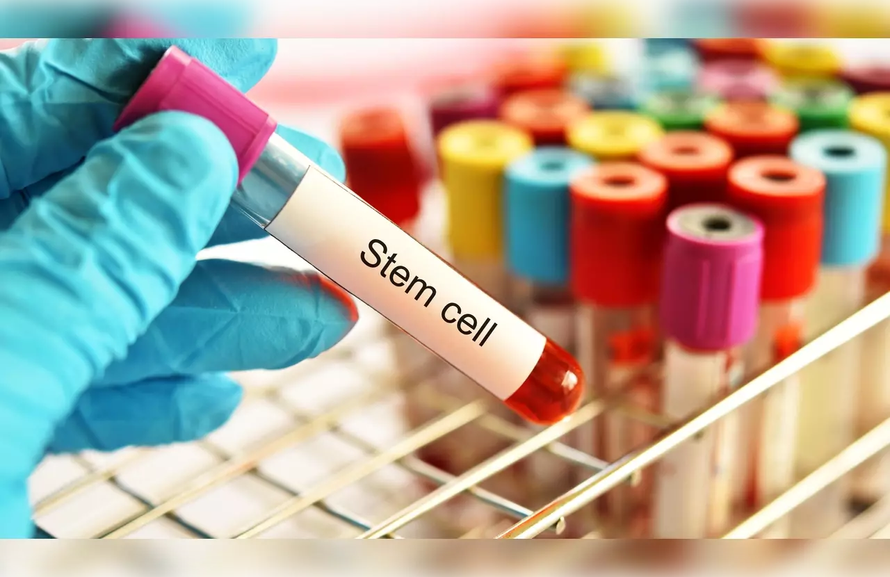 autologous stem cell transplant