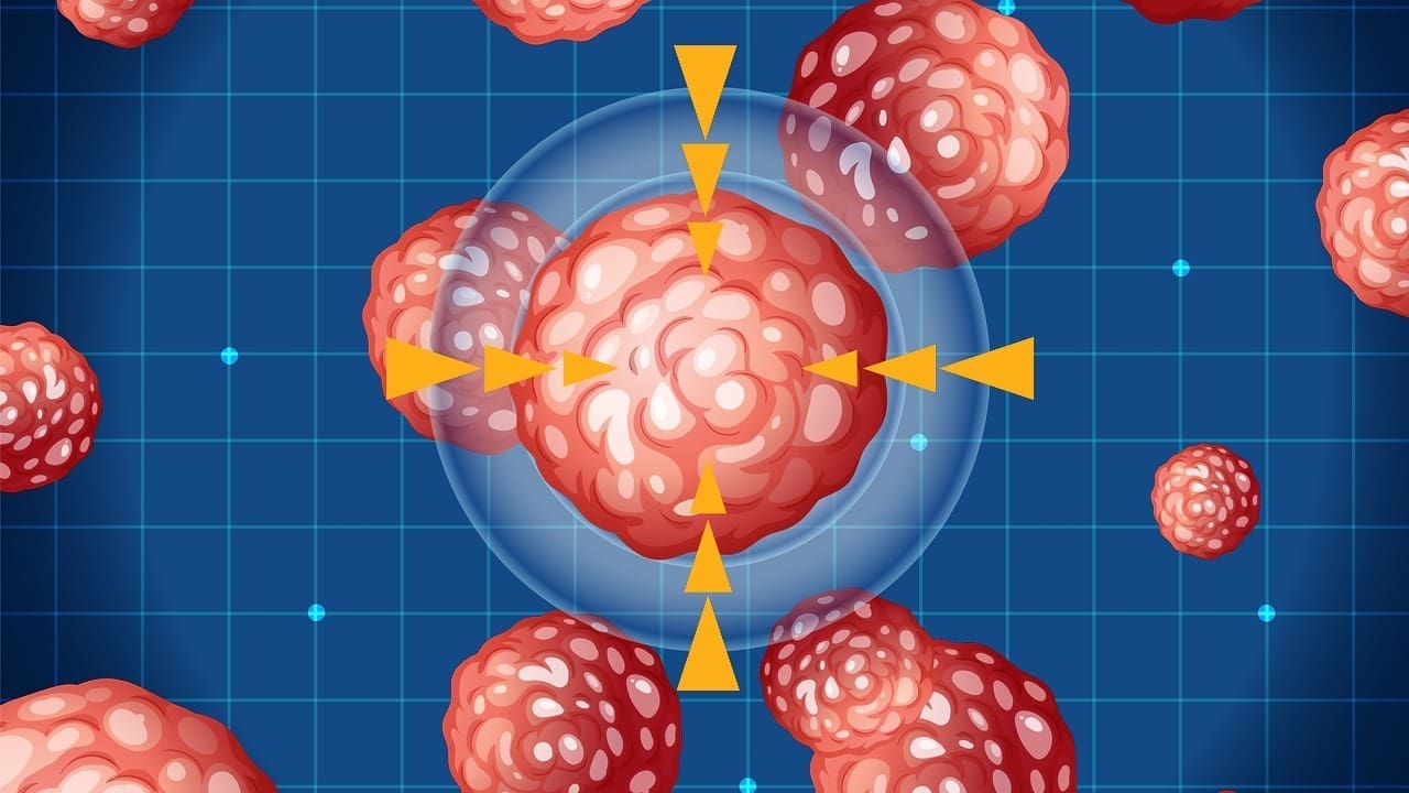average artery blockage by age