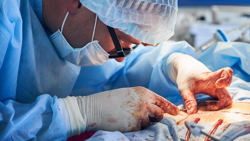 back surgery for pinched nerve